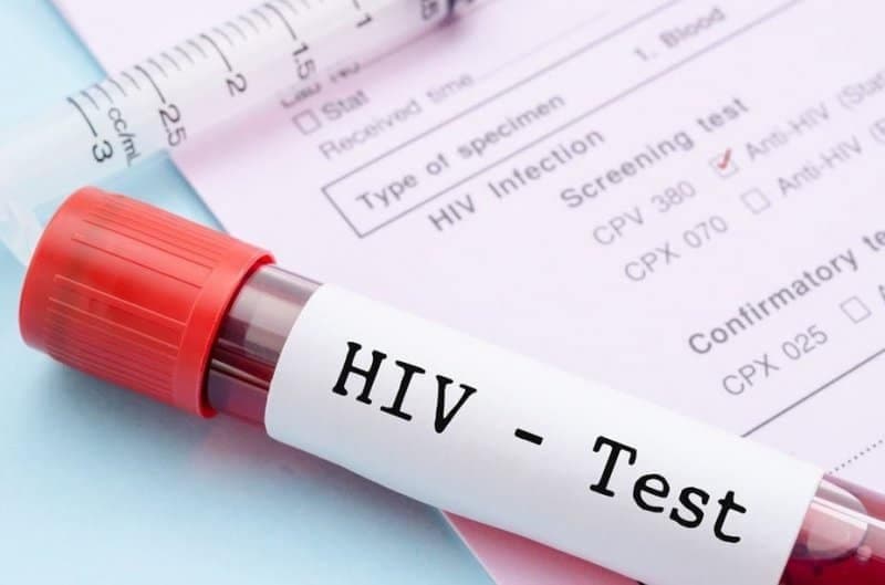 over-70-of-ghanaians-less-than-50-years-discriminate-against-hiv-patients