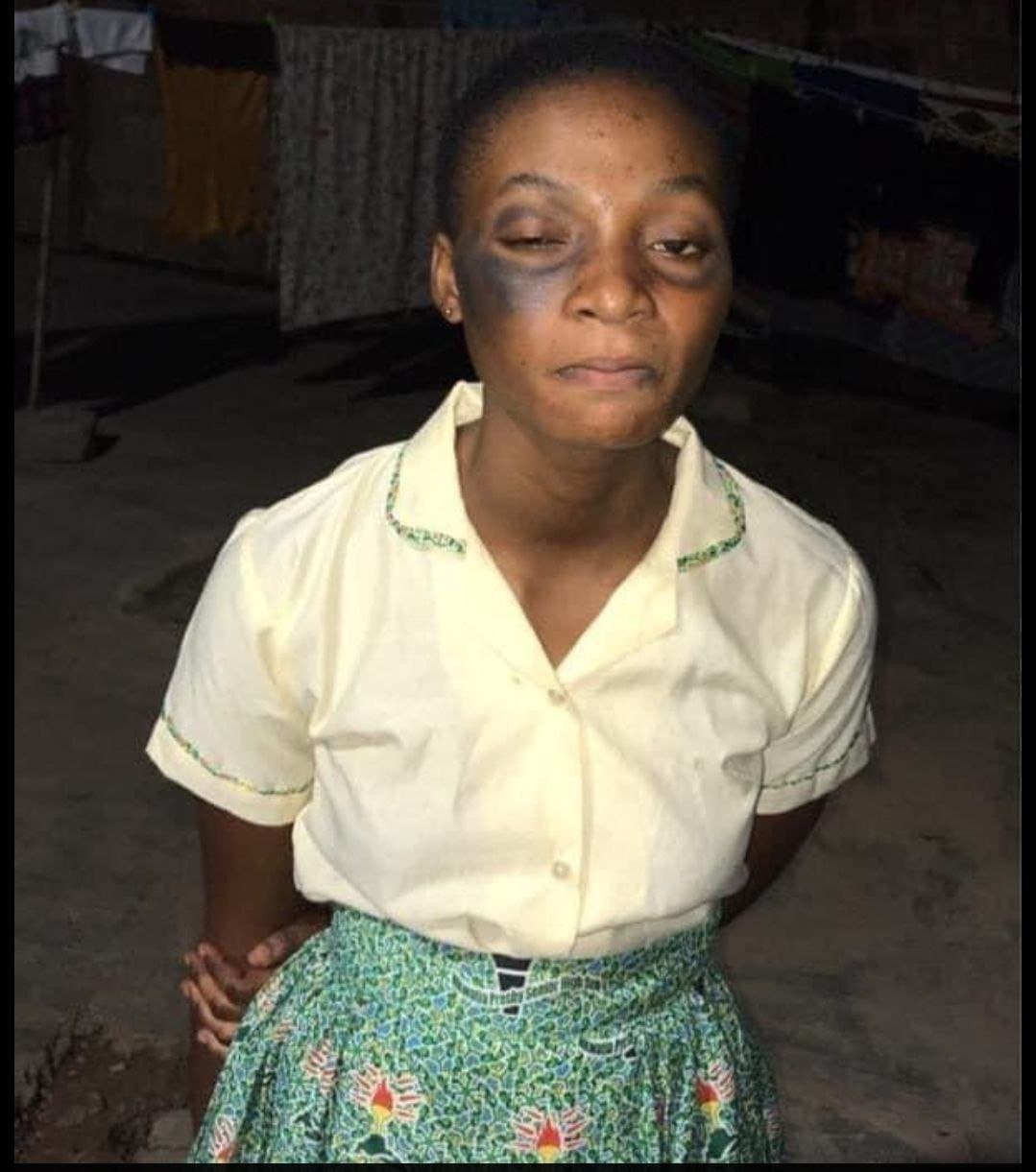 victim-of-assault-at-nkwatia-presby-shs-receiving-medical-care-ges