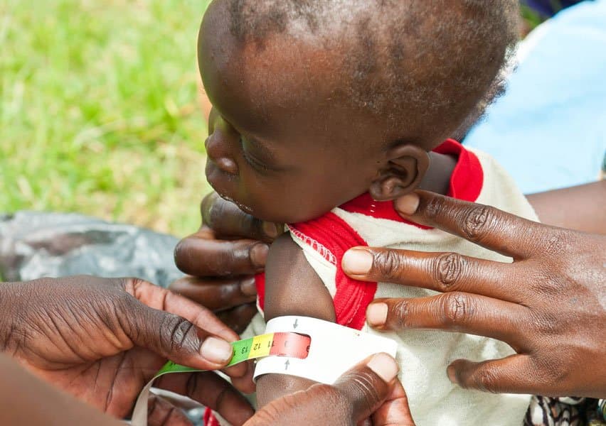 malnutrition-claims-two-childrens-lives-in-bawku